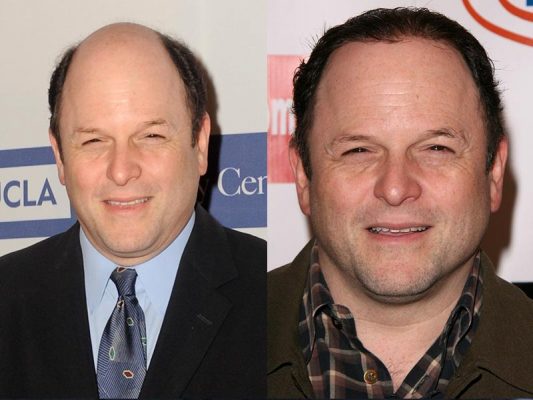 12 Male Celebs With Toupee – hair system